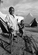 Child victim of landmine